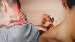 Fibromiyalji hastalarına mucize tedavi! Kuru iğne tedavisi ağrı noktaları…