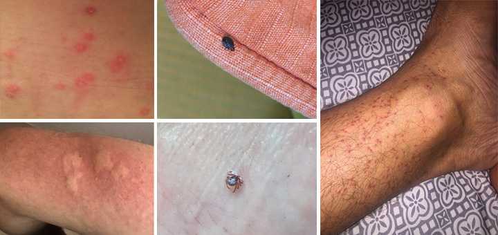 Komşu'da Alarm Verildi! "Tahtakurusu" İstilası... 2 bocek kapak