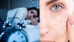 Eğer Günde 8 Saat Uyku Uyumuyorsanız… Cildinize Bunlar Olabilir!