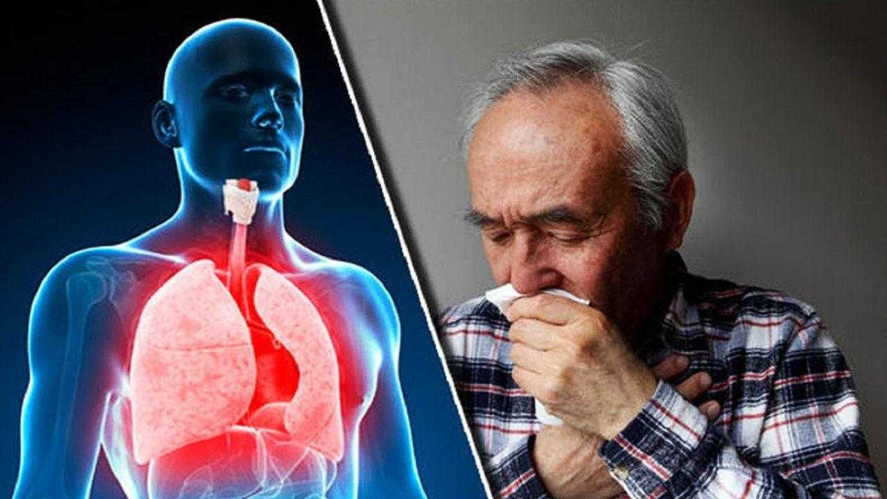 her yil 300 bin kisi oluyor koah hastaligi nedir belirtileri nelerdir 4 JYjaD7YB