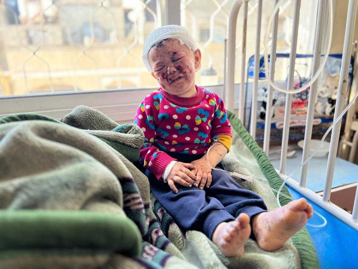 Gazze'de 2 Yaşındaki Çocuğun Yürek Yakan Fotoğrafı 1 2 yasindaki cocugun yurek yakan fotografi 1 LMUPLI6z