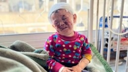 Gazze’de 2 Yaşındaki Çocuğun Yürek Yakan Fotoğrafı