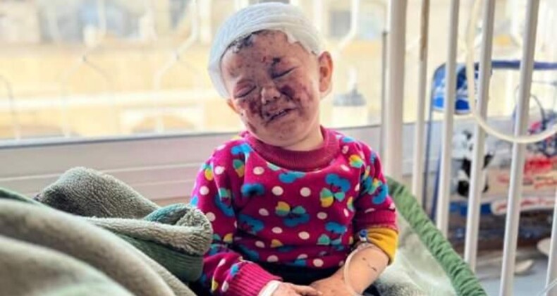 Gazze’de 2 Yaşındaki Çocuğun Yürek Yakan Fotoğrafı