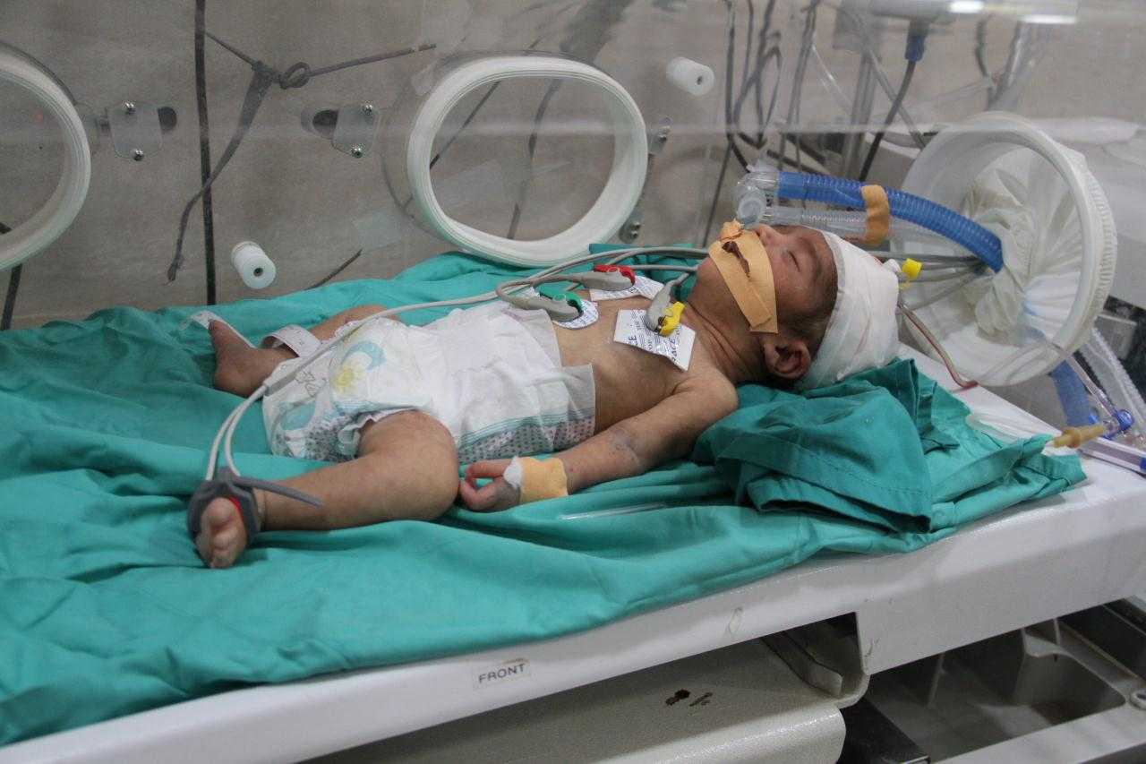 Fransız Gazetesi Liberation, Gazze'de Açlıktan Ölen İnsanlarla Dalga Geçti 3 fransiz gazetesi liberation gazzede acliktan olen insanlarla dalga gecti 3 LIA2QpuN
