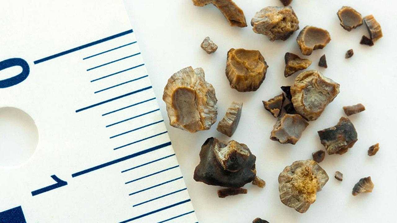 Ramazan Ayı’nda Böbreklere Dikkat! Eğer Bunları Yapmazsanız Böbrek Sağlığınız Tehlikede! 1 ramazan ayinda bobreklere dikkat eger bunlari yapmazsaniz bobrek sagliginiz tehlikede 1 uVcdZ9CL