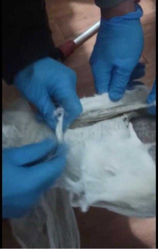 Yolcunun Ayağına Sarılı Alçından Eroin Çıktı 1 yolcunun ayagina sarili alcindan eroin cikti 1 V32bFFUT