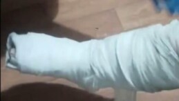 Yolcunun Ayağına Sarılı Alçından Eroin Çıktı