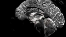 Dünyanın En Büyük MRI Cihazıyla Çekildi: İnsan Beyni İlk Kez Bu Kadar Net Görüntülendi…