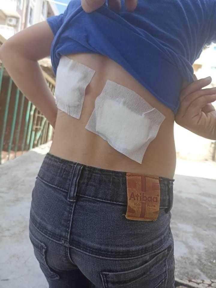 Başıboş Sokak Köpekleri Diyarbakır'da Bir Çocuğu Hastanelik Etti 1 basibos sokak kopekleri diyarbakirda bir cocugu hastanelik etti 1 dfCyiW5h
