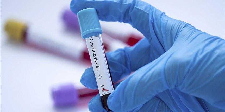 ilac devi astrazeneca yan etkileri nedeniyle covid 19 asisini kuresel capta geri cekti 3 EUKNyEQs