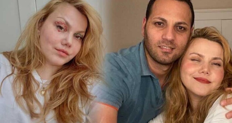 Fenomen Eşini 58 Yerinden Bıçaklamıştı! Cezası Belli Oldu
