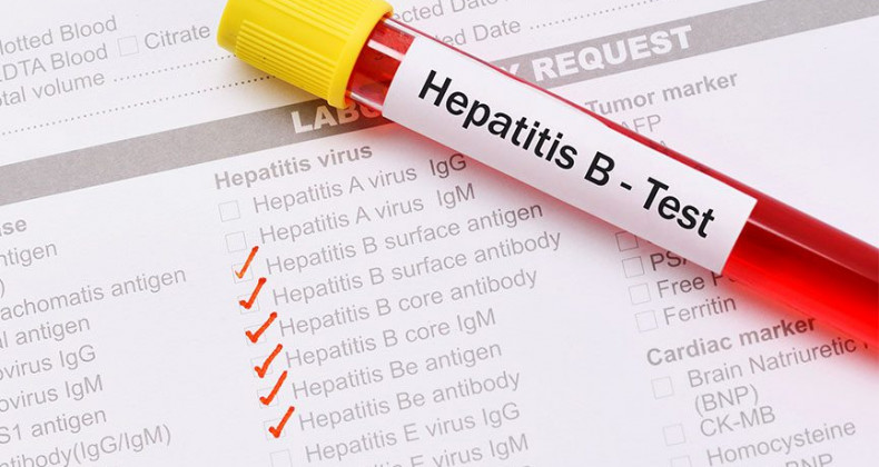 Hepatit B Tedavi Edilmezse Karaciğer Sirozuna Yol Açabilir