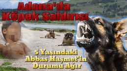 Adana’da 5 Yaşındaki Çocuğa Köpek Saldırdı: “Durumu Ağır!”