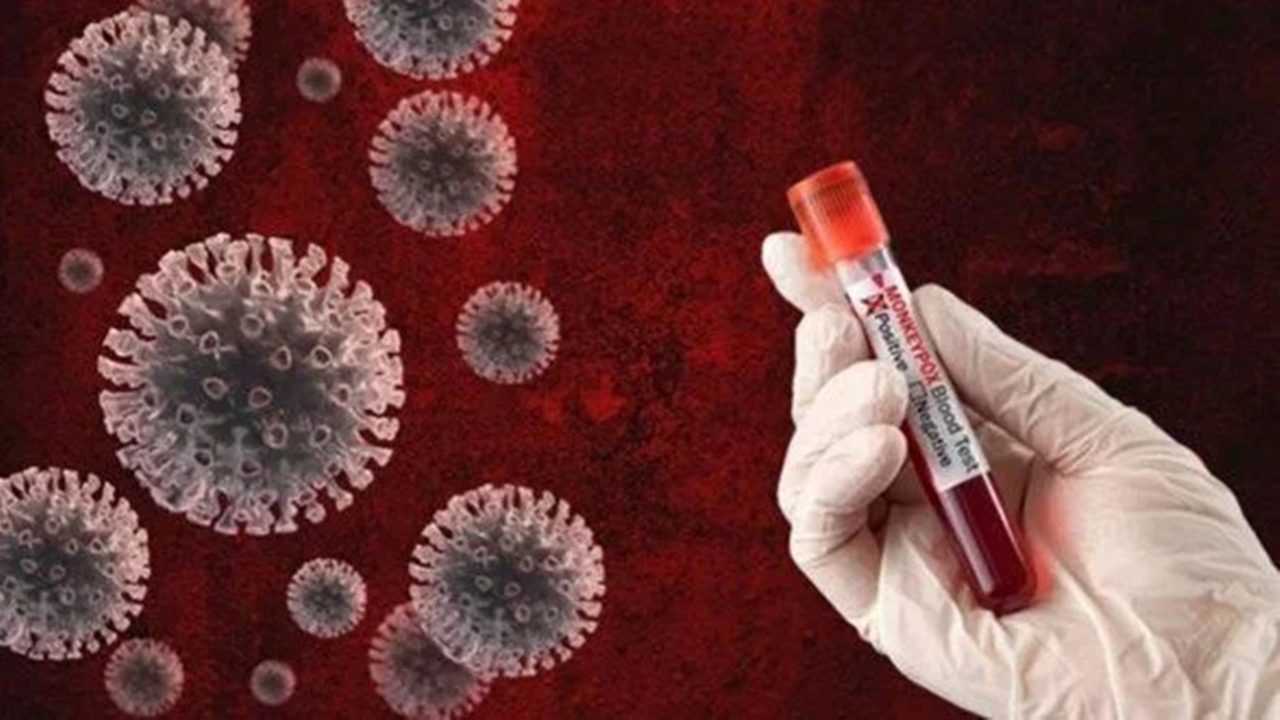 Akciğer Kanseri Tedavisinde Çığır Açacak Gelişme 2 Akciger Kanseri Tedavisinde Cigir Acacak Gelisme 3