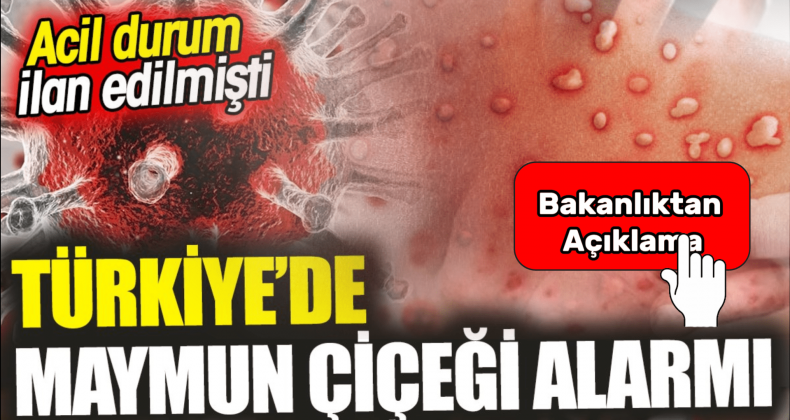 Türkiye Mpox Alarmında mı? Bakanlıktan Kritik Açıklama!