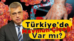 Türkiye’de Maymun Çiçeği Virüsü Görüldü mü? Bakan Açıkladı