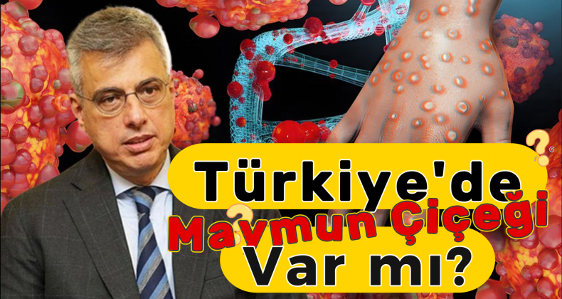 Türkiye’de Maymun Çiçeği Virüsü Görüldü mü? Bakan Açıkladı