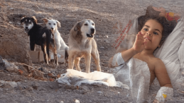 Ankara’da Köpek Saldırısı: 5 Yaşındaki Elif Yoğun Bakımda