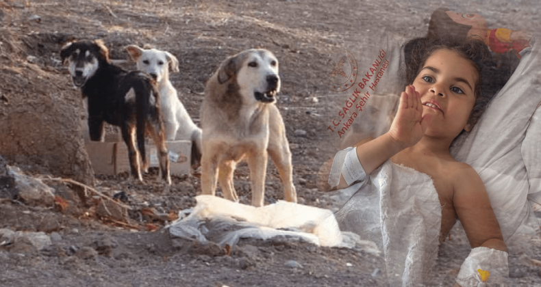 Ankara’da Köpek Saldırısı: 5 Yaşındaki Elif Yoğun Bakımda