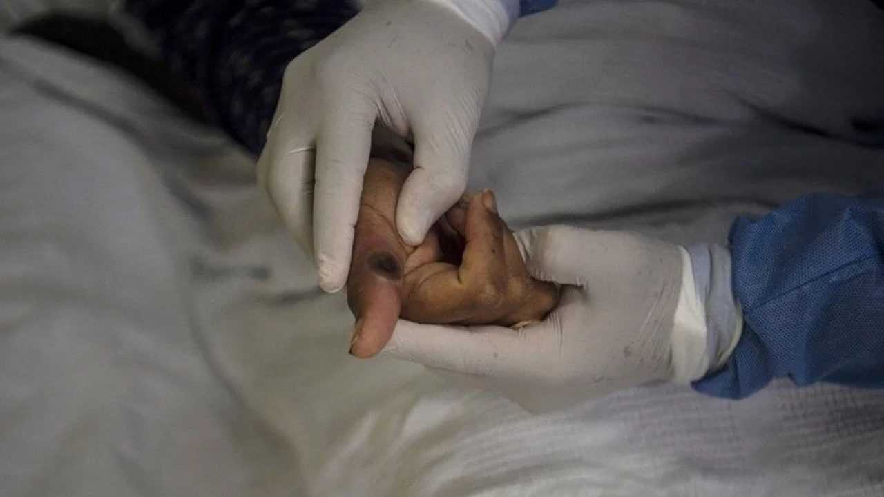 Istanbulda Mpox Krizi Havalimani Alarmda 5