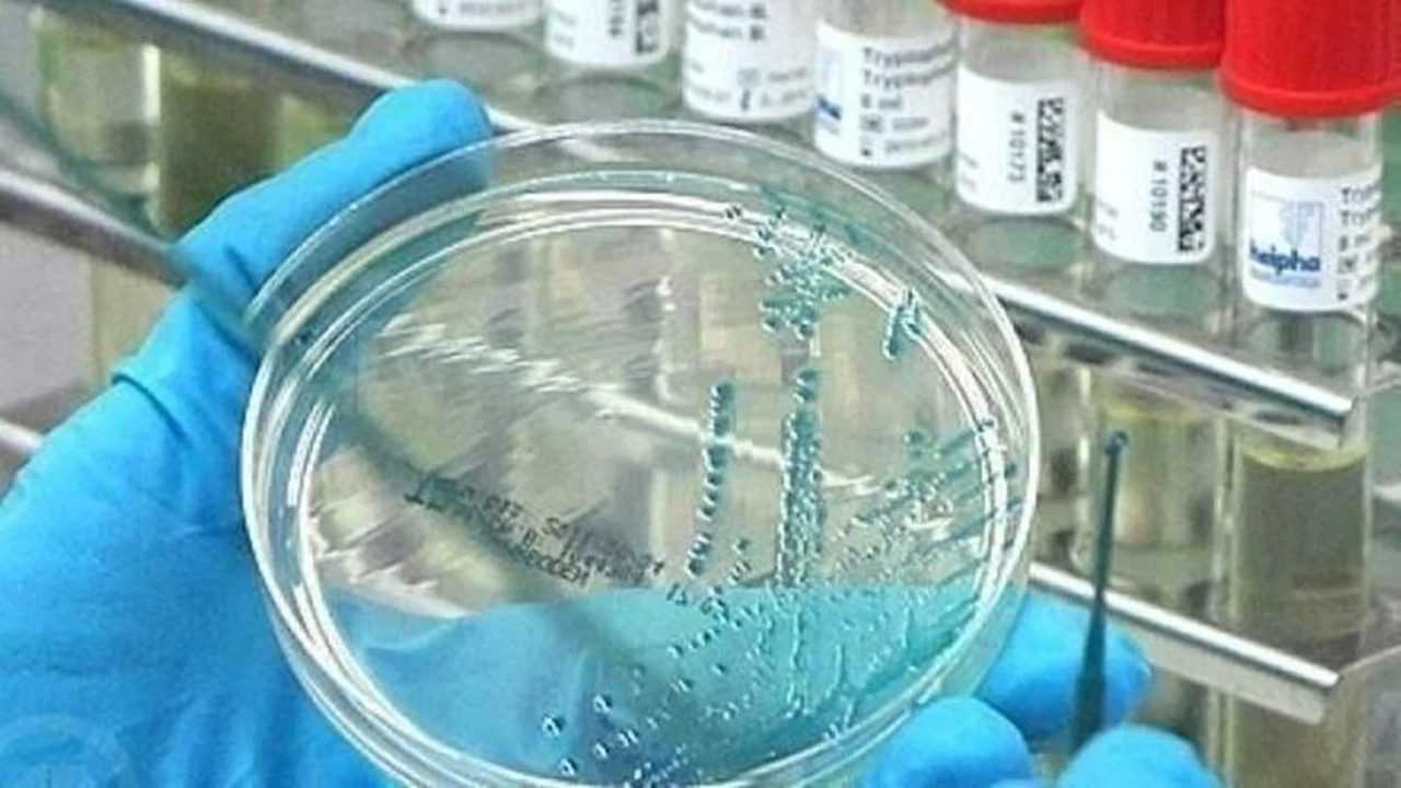 Maymun Çiçeği Krizi: DSÖ'den Küresel Acil Durum İlanı 1 Maymun Cicegi Krizi DSOden Kuresel Acil Durum Ilani 2