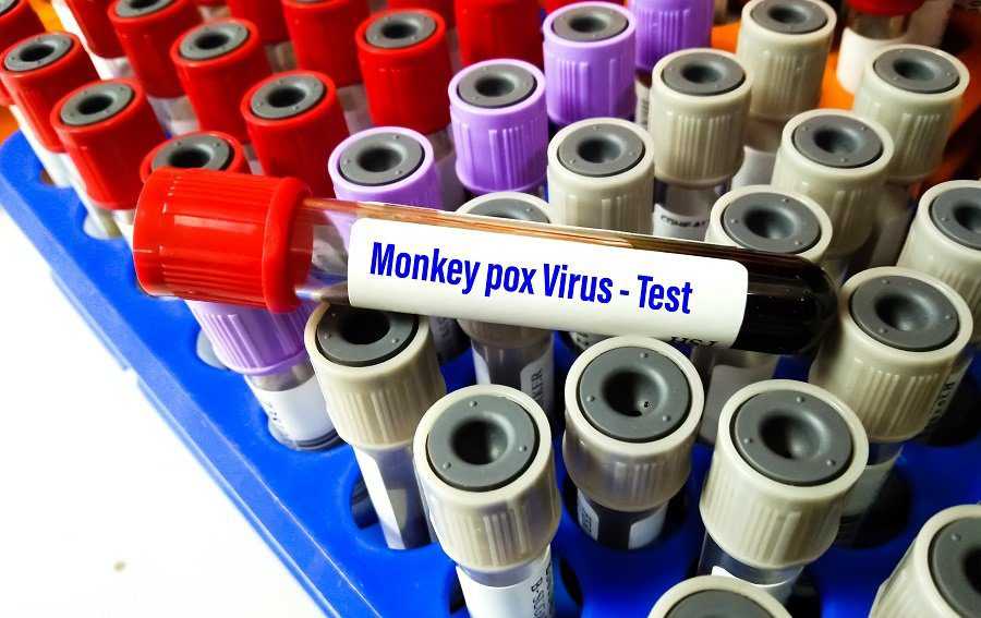 monkeypox virus