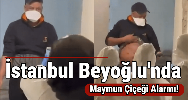 İstanbul’da M Çiçeği Virüsü İddiaları!