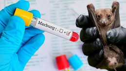 Ruanda’da Marburg Virüsü Nedeniyle 6 Kişi Öldü