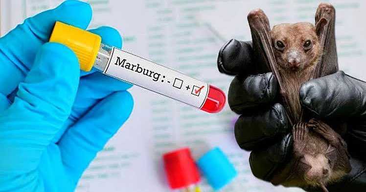 Ruanda’da Marburg Virüsü Nedeniyle 6 Kişi Öldü