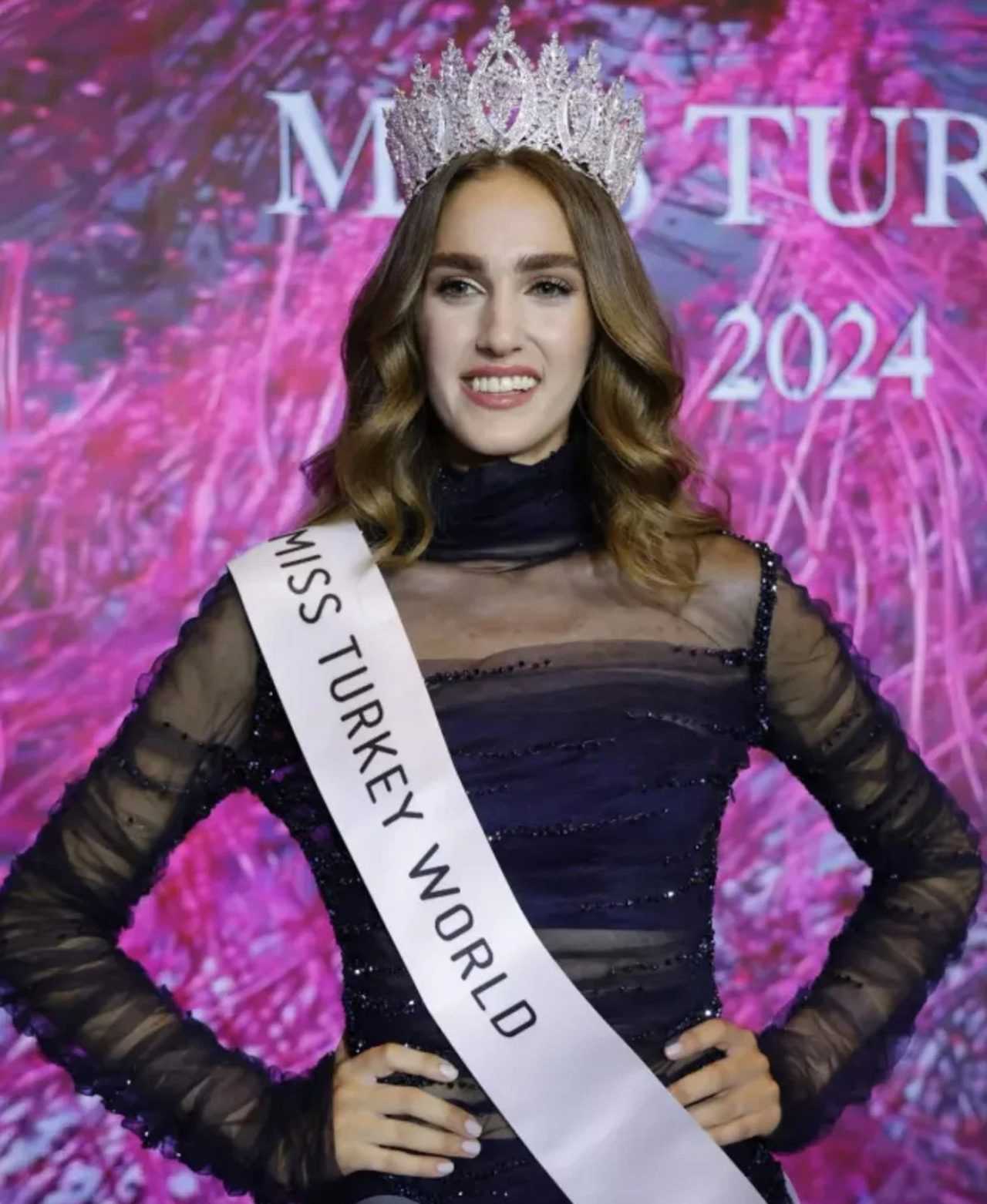 Tıp Mezunu İdil Bilgen Miss Turkey 2024 Güzeli Seçildi 2 Tip Mezunu Idil Bilgen Miss Turkey 2024 Guzeli Secildi 3