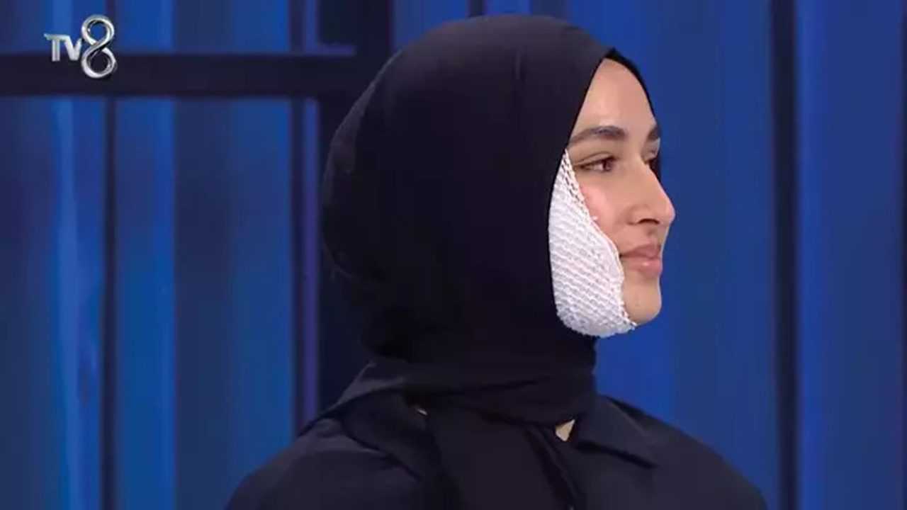 MasterChef'te Kaza: Beyza, Yanmış Yüzüne Rağmen Geri Döndü 2 MasterChefte Kaza Beyza Yanmis Yuzune Ragmen Geri Dondu 3