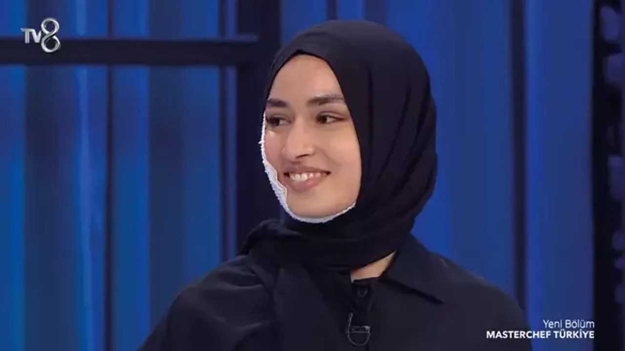 MasterChef'te Kaza: Beyza, Yanmış Yüzüne Rağmen Geri Döndü 4 MasterChefte Kaza Beyza Yanmis Yuzune Ragmen Geri Dondu 5