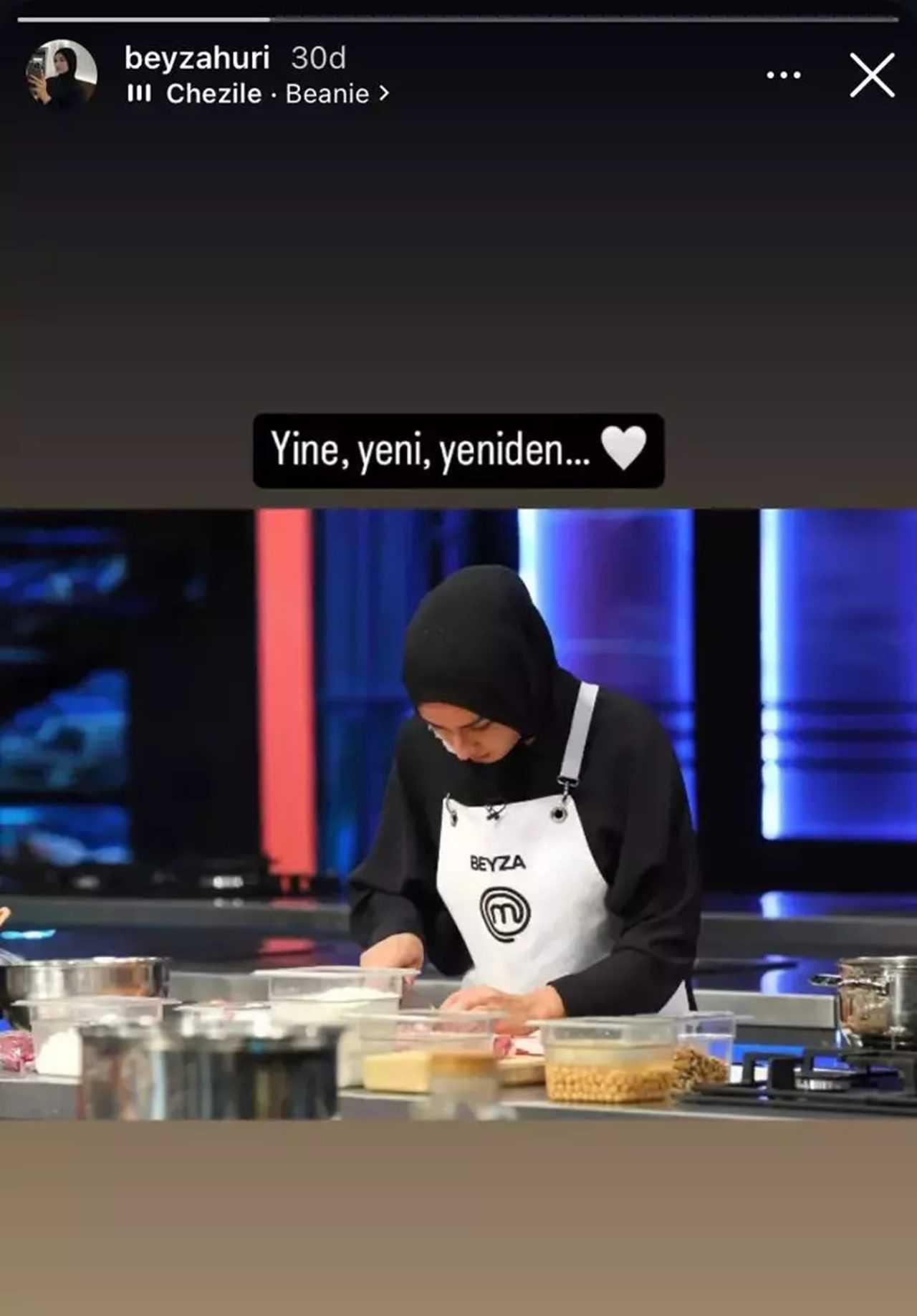 MasterChef'te Kaza: Beyza, Yanmış Yüzüne Rağmen Geri Döndü 6 MasterChefte Kaza Beyza Yanmis Yuzune Ragmen Geri Dondu 7