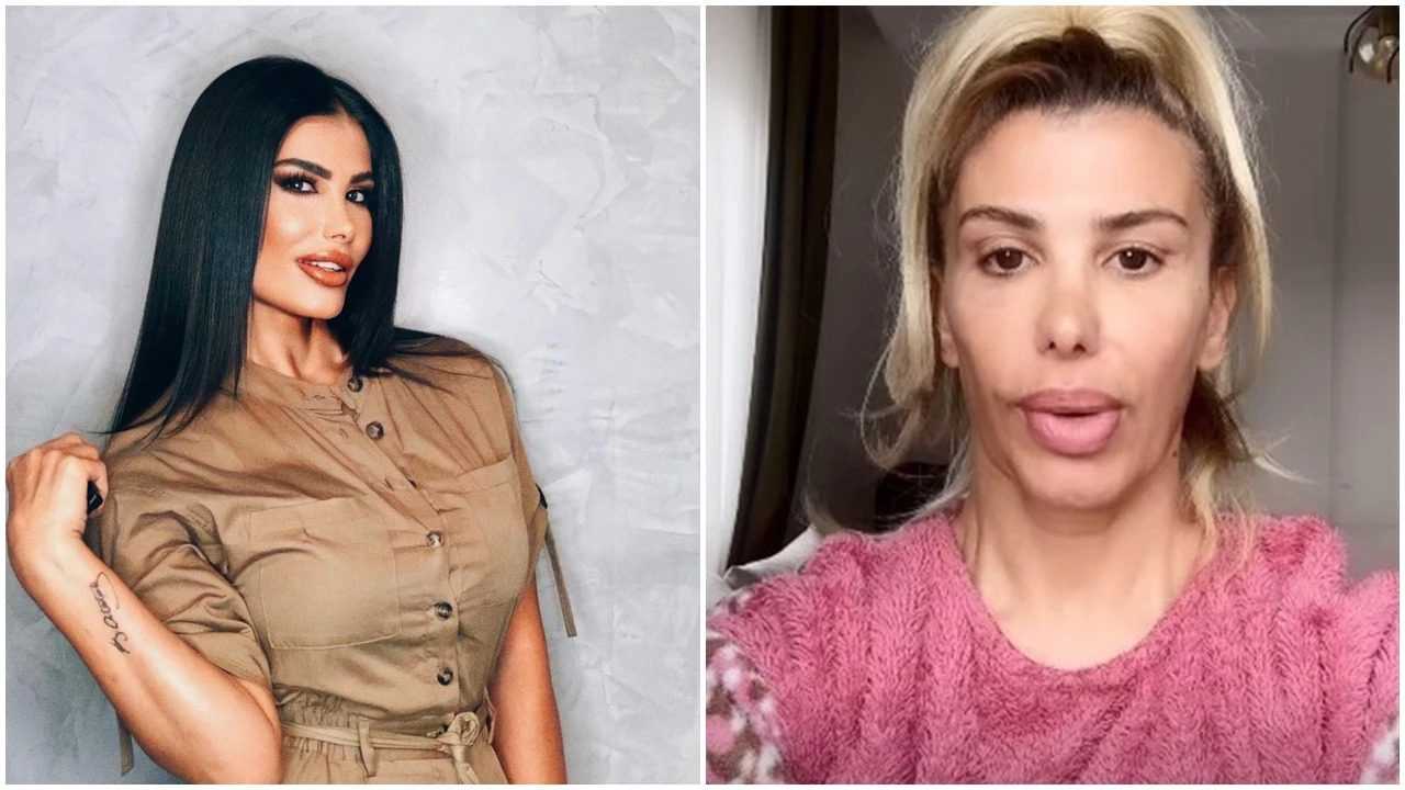 Hatice’nin Kâbusu: Botoks Sonrası Zehirlendi 1 Haticenin Kabusu Botoks Sonrasi Zehirlendi 2