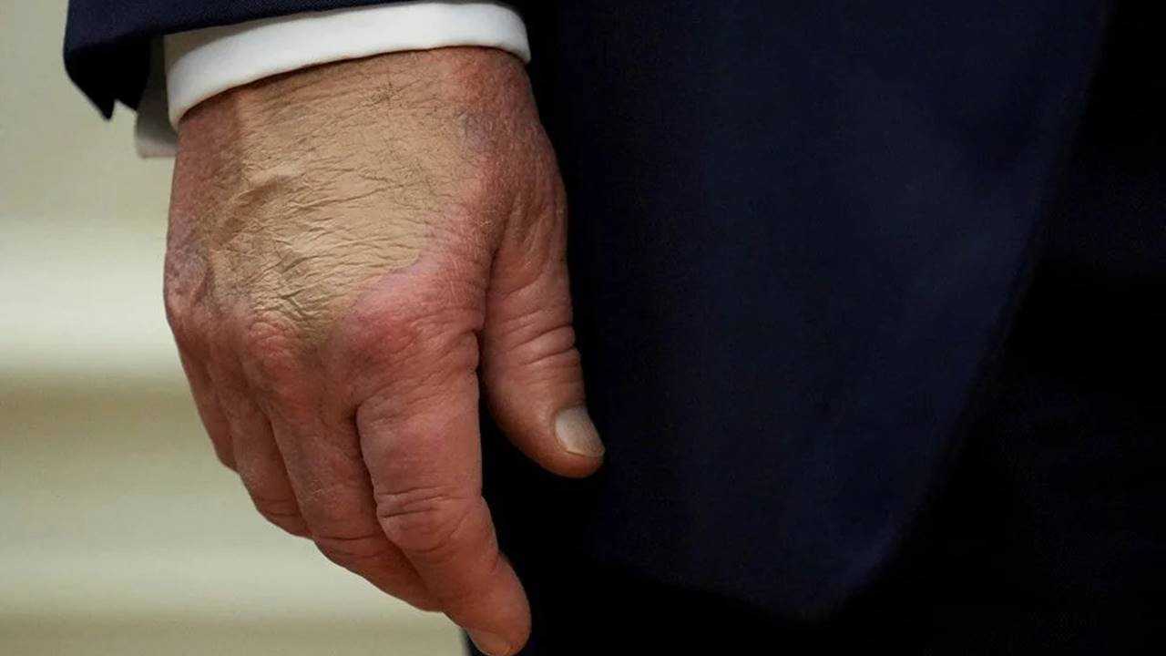 79 Yaşındaki Trump, Kronolojik Yaşının 14 Yıl Genç 2 79 Yasindaki Trump Kronolojik Yasinin 14 Yil Genc 2