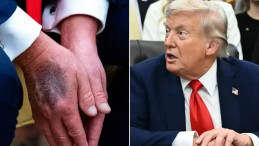 79 Yaşındaki Trump, Kronolojik Yaşının 14 Yıl Genç