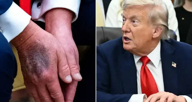 79 Yaşındaki Trump, Kronolojik Yaşının 14 Yıl Genç