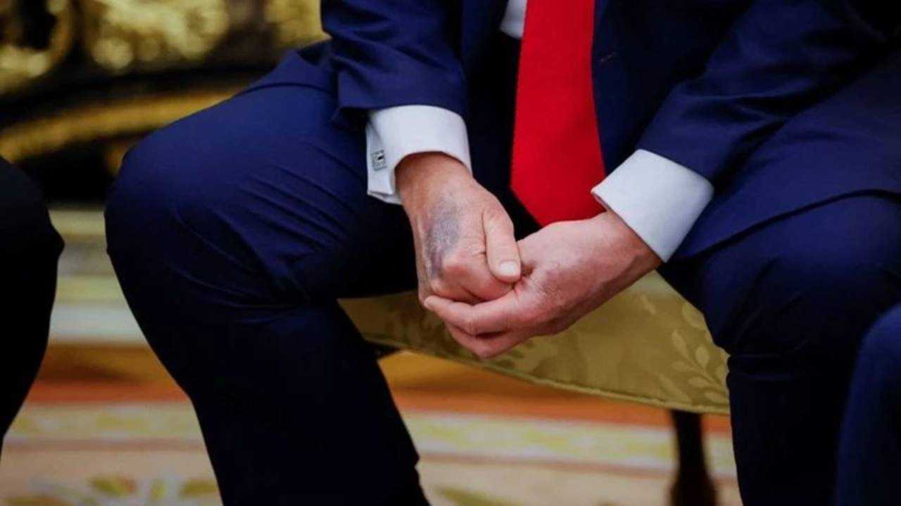 79 Yaşındaki Trump, Kronolojik Yaşının 14 Yıl Genç 3 79 Yasindaki Trump Kronolojik Yasinin 14 Yil Genc 4