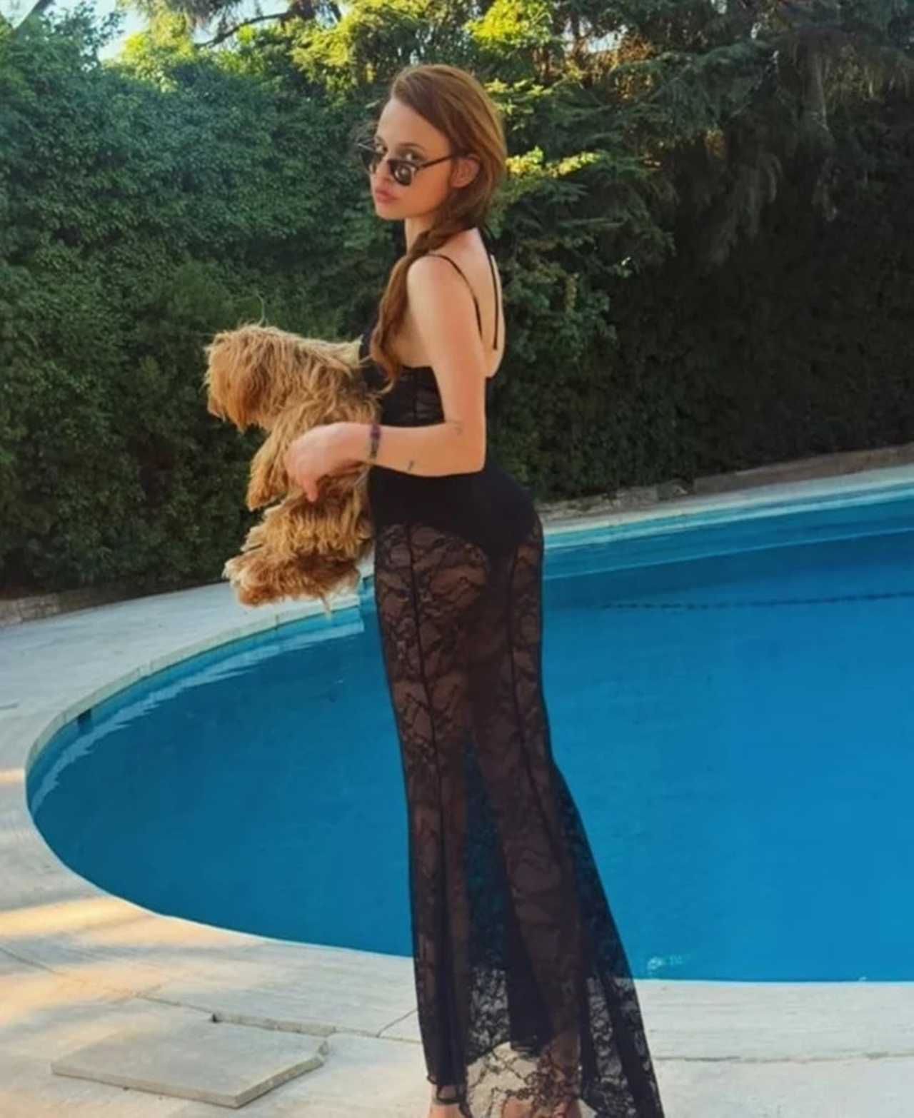 Naz Elmas'ın Son Hali Sosyal Medyayı İkiye Böldü 1 Naz Elmasin Son Hali Sosyal Medyayi Ikiye Boldu 2