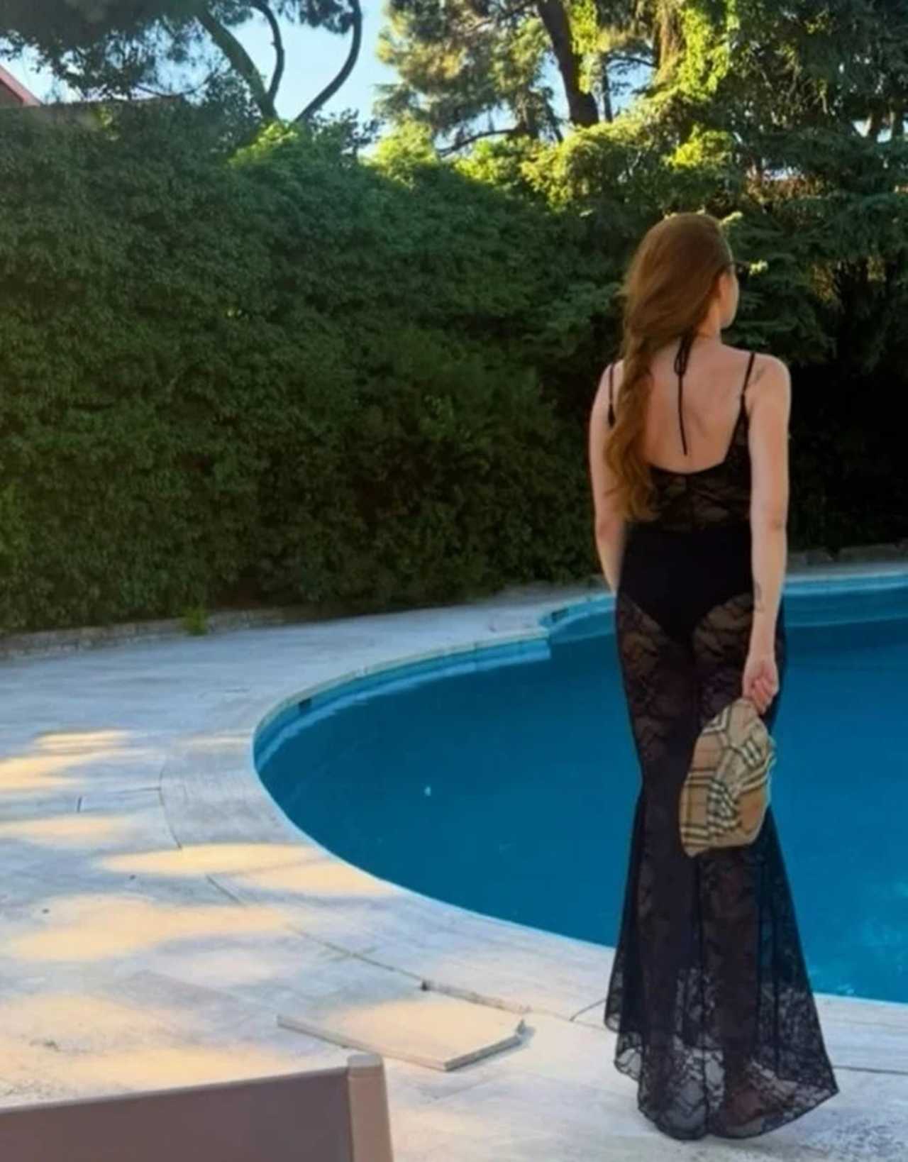 Naz Elmas'ın Son Hali Sosyal Medyayı İkiye Böldü 2 Naz Elmasin Son Hali Sosyal Medyayi Ikiye Boldu 3